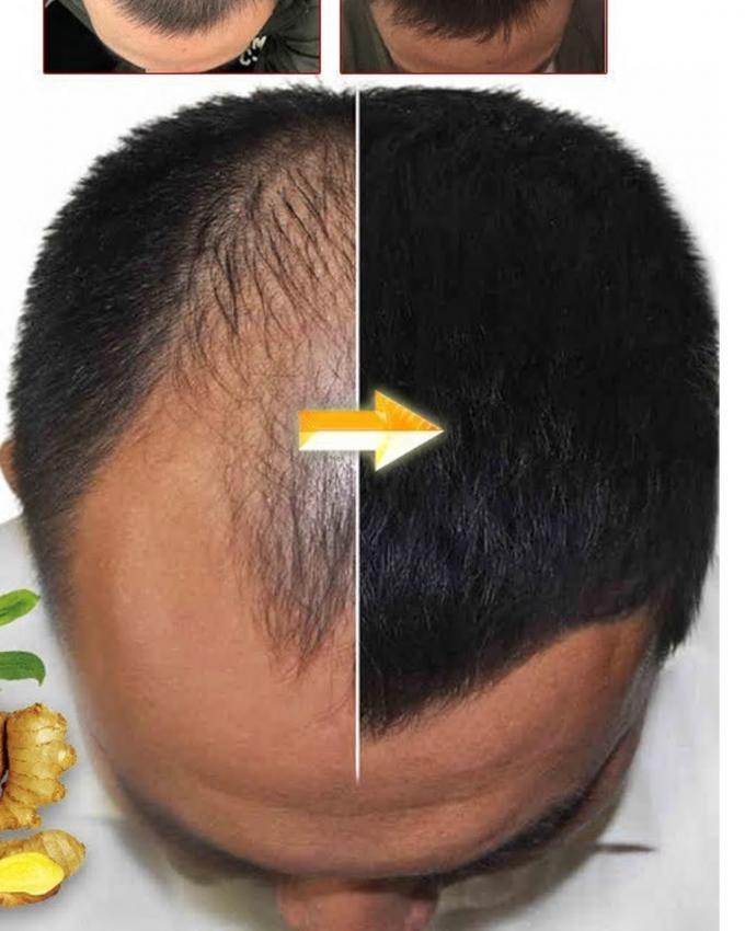 Moroccon Argan Oil for Hair growth Restoration and Hair Loss prevention
